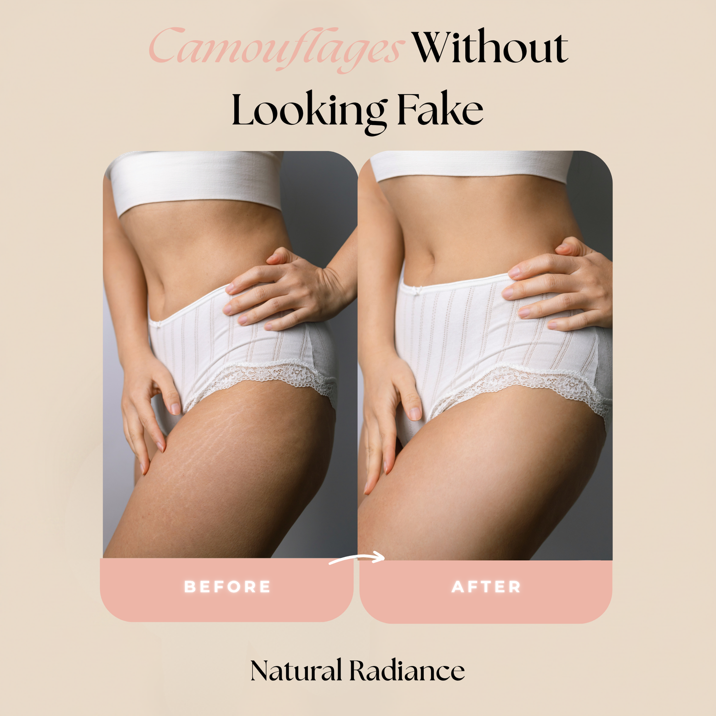Concele™ Body Makeup