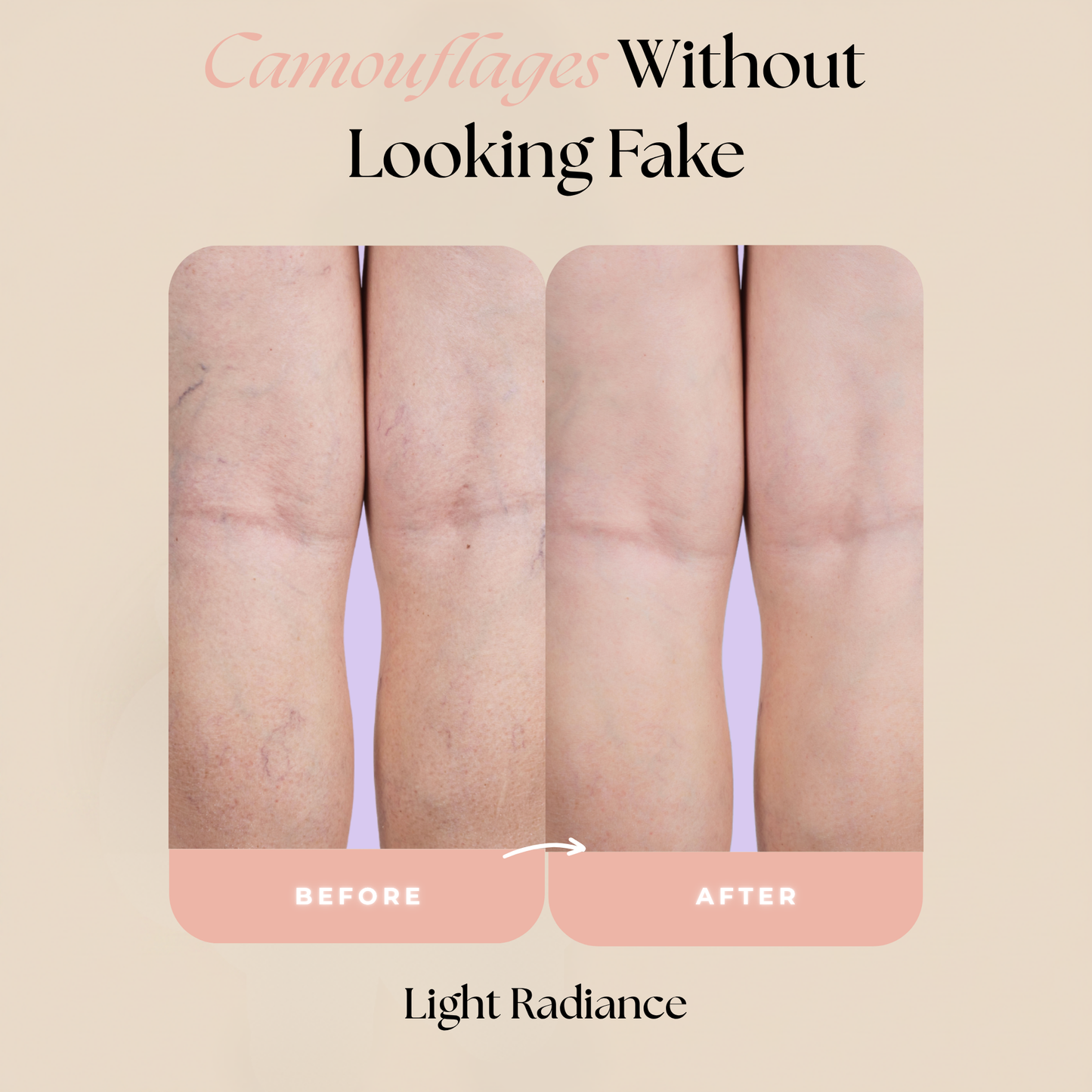 Concele™ Body Makeup