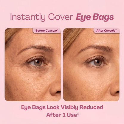 Instant Eye Firmer