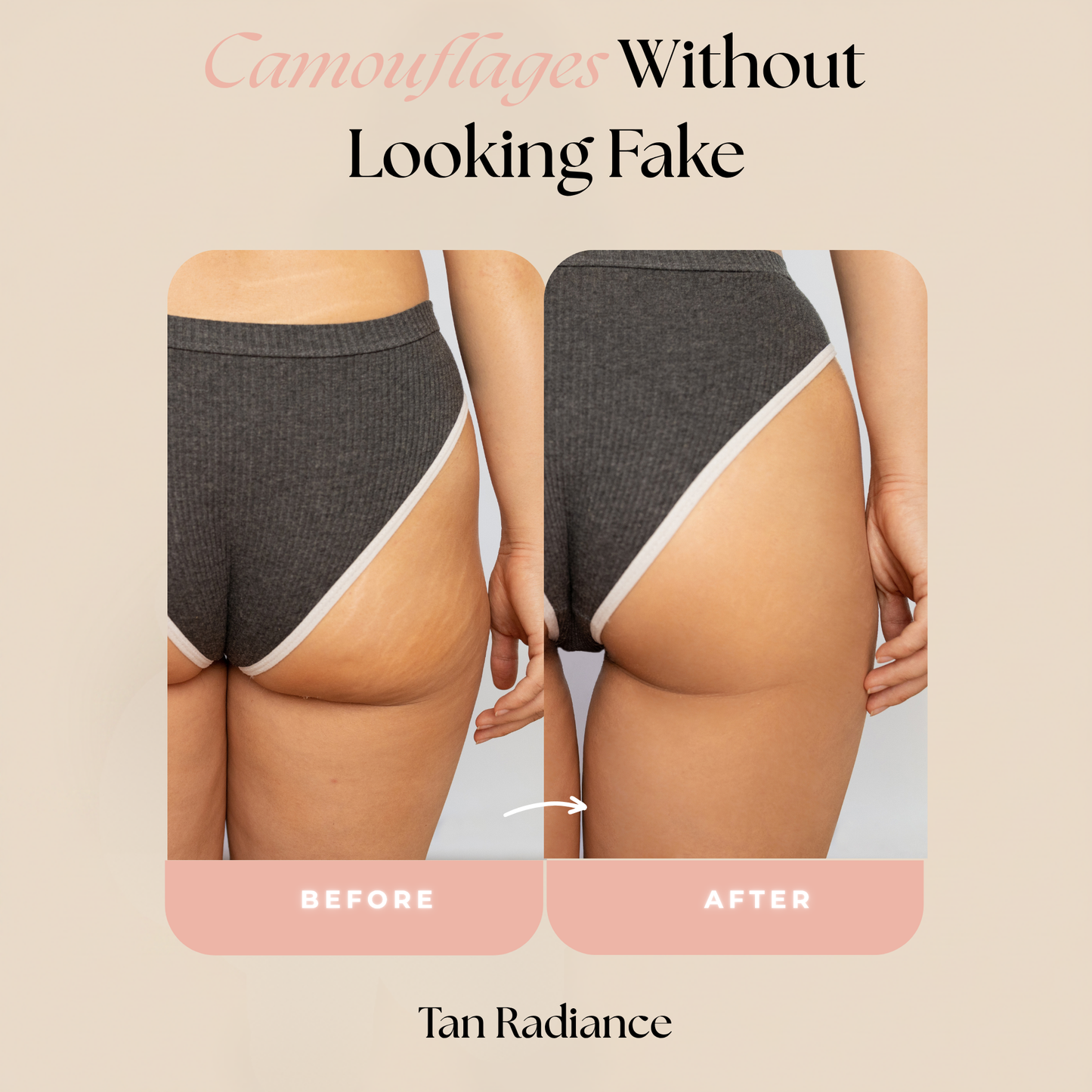 Concele™ Body Makeup