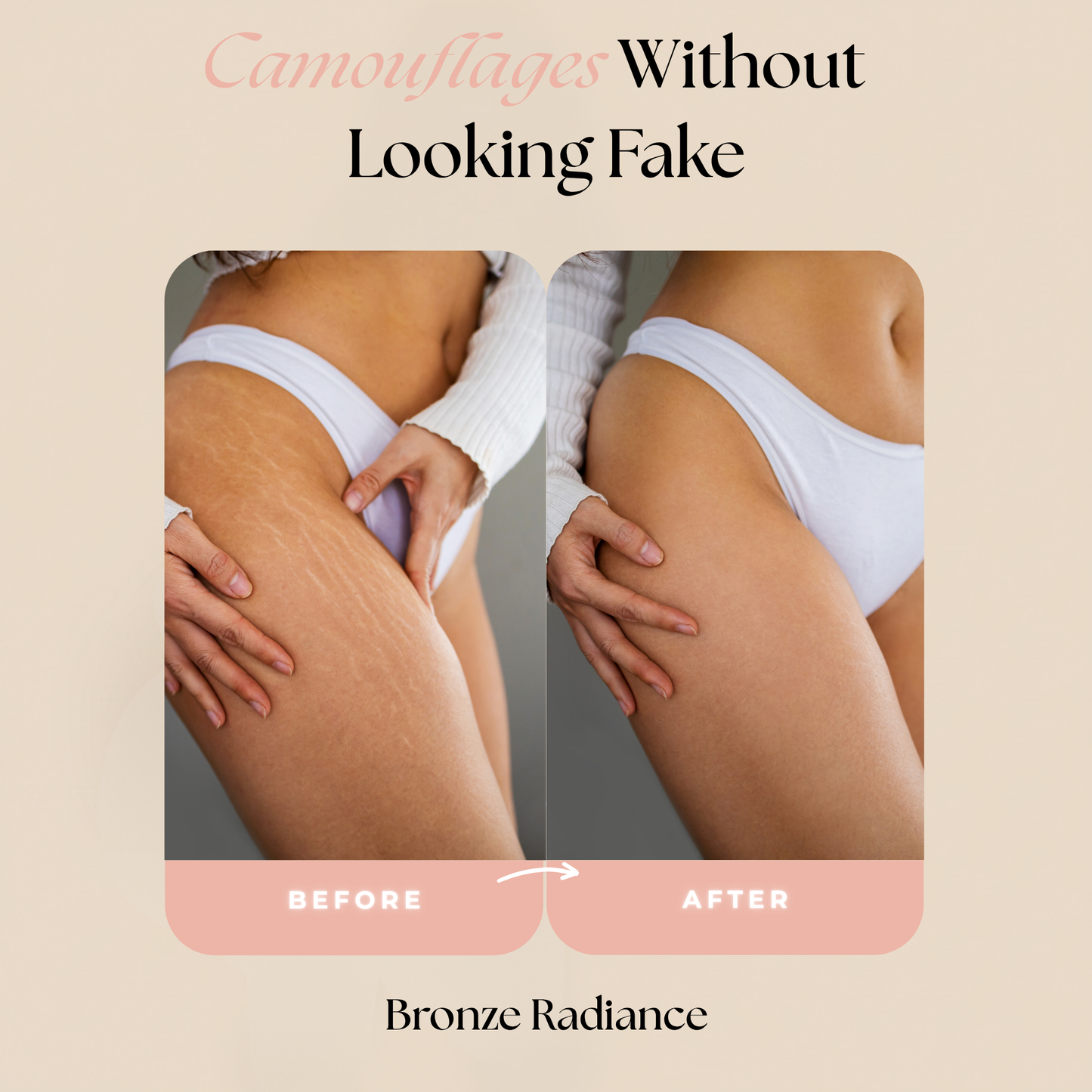 Concele™ Body Makeup