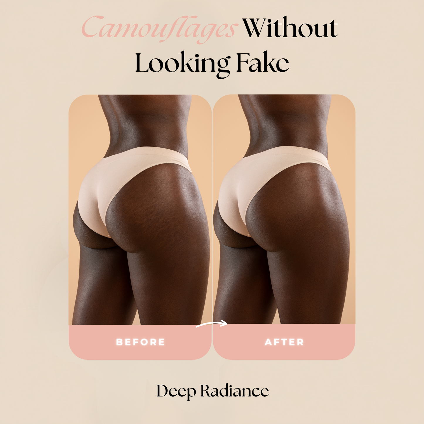 Concele™ Body Makeup