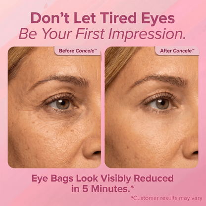 Instant Eye Renewal Gel