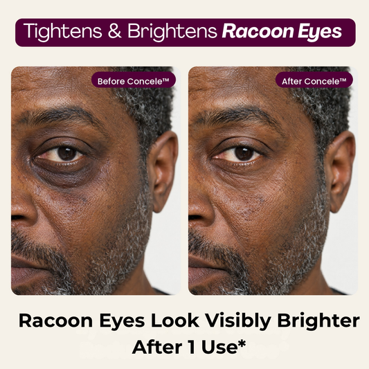 Concele™ Calcium Eye Firmer