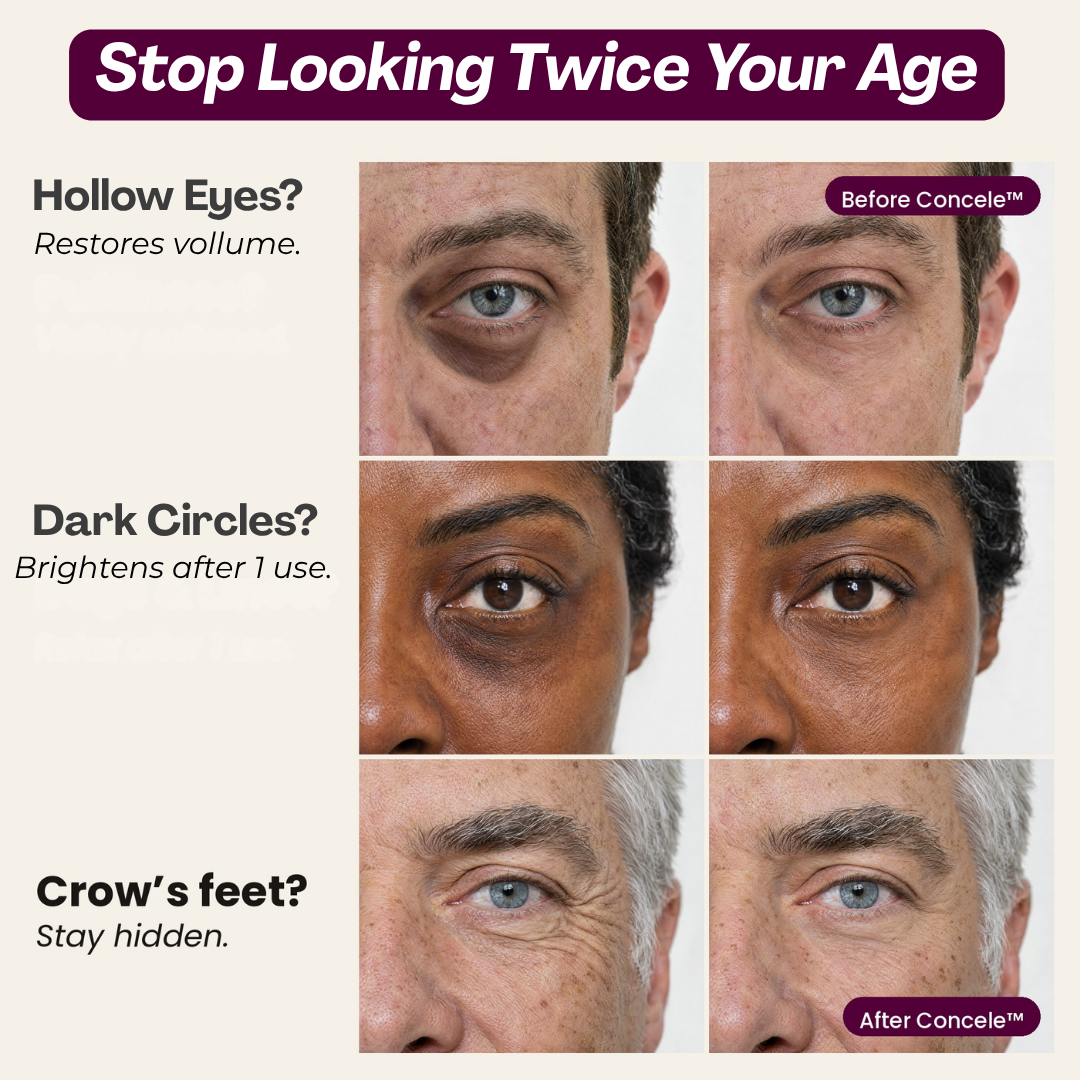 Concele™ Calcium Eye Firmer