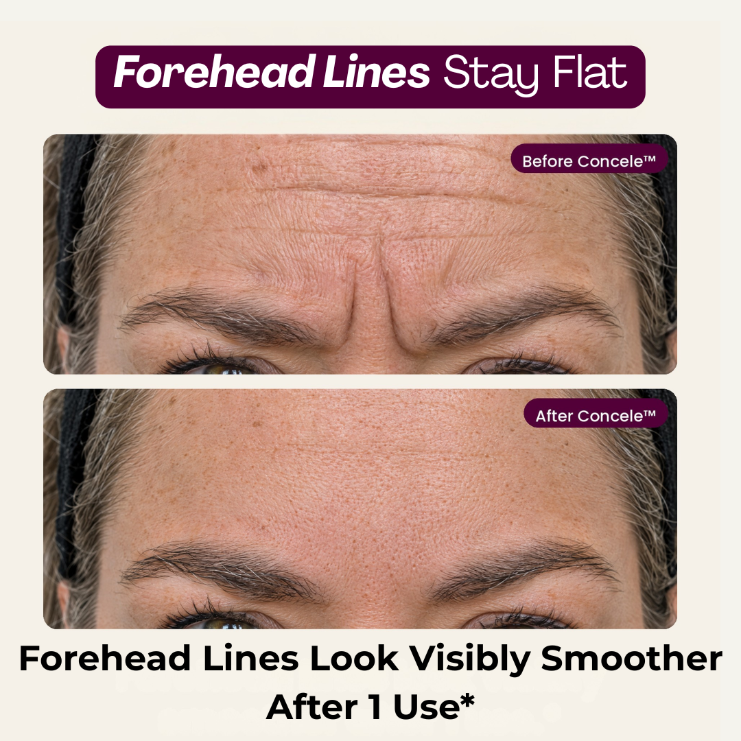 Concele™ Calcium Eye Firmer