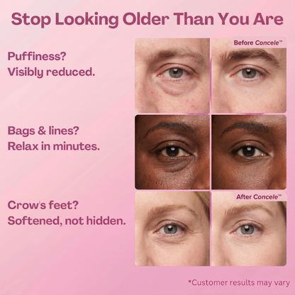 Instant Eye Renewal Gel
