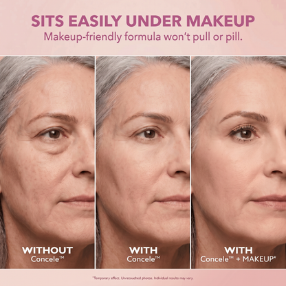 Instant Eye Renewal Gel
