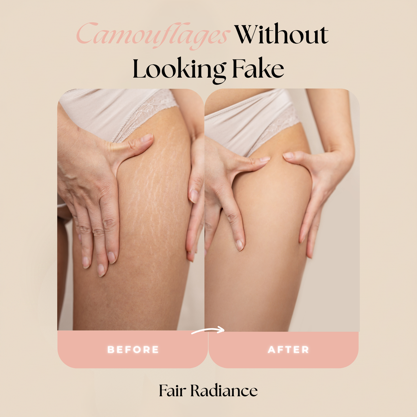 Concele™ Body Makeup