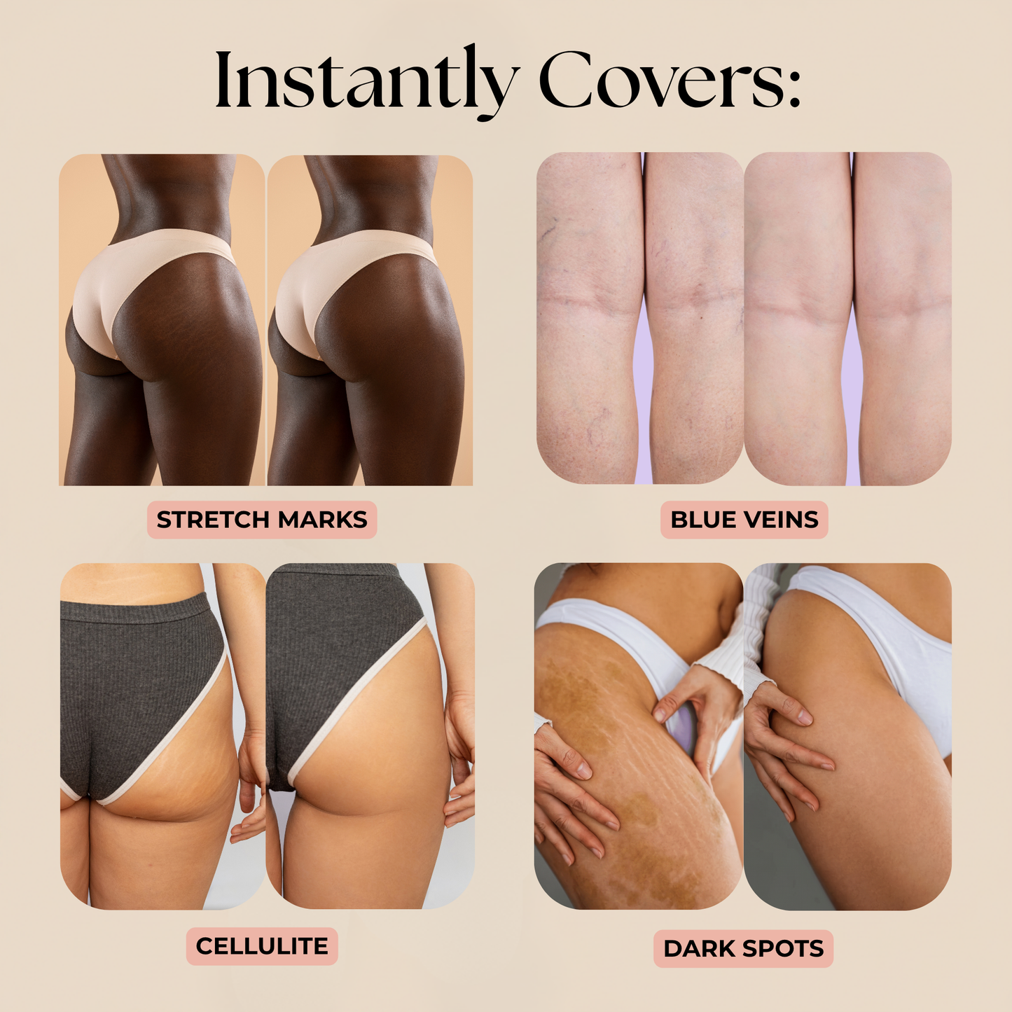 Concele™ Body Makeup