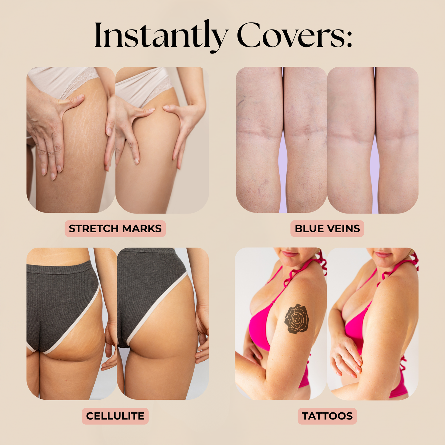 Concele™ Body Makeup