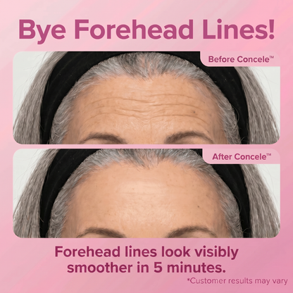 Instant Eye Renewal Gel