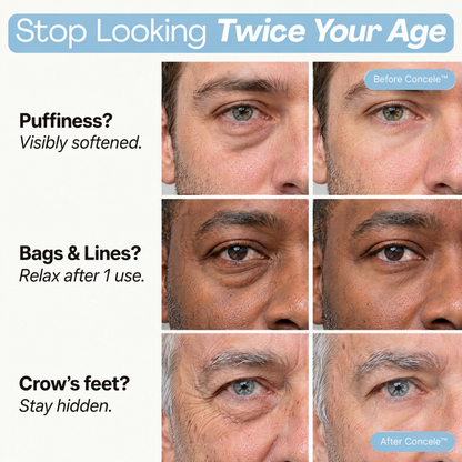 Concele™ Peptide Eye Firmer