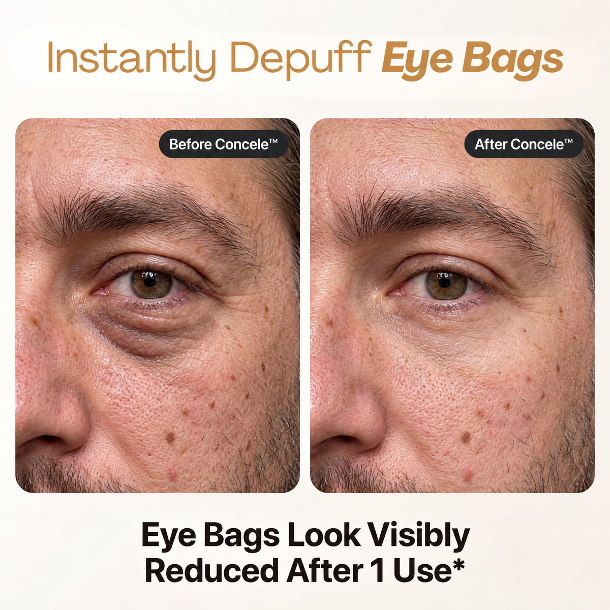 Concele™ Instant Eye Firmer