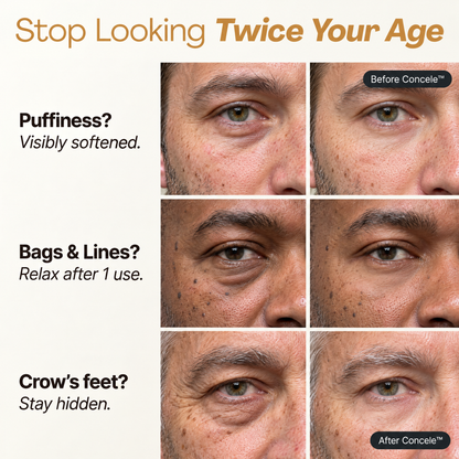 Concele™ Instant Eye Firmer